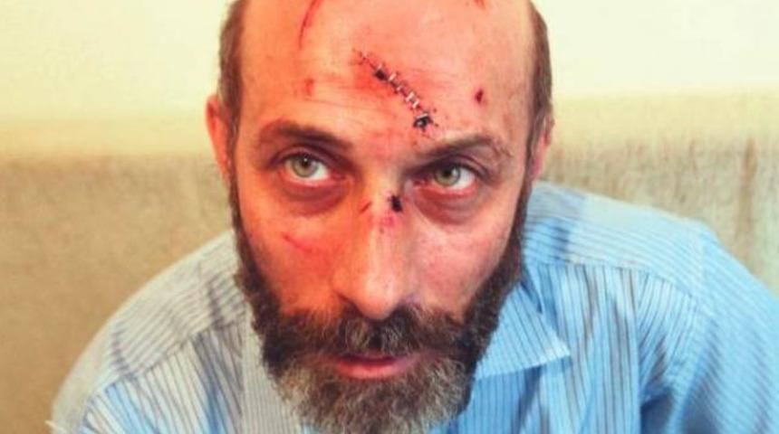 Veysel Dalsaldı'ya feci dayak