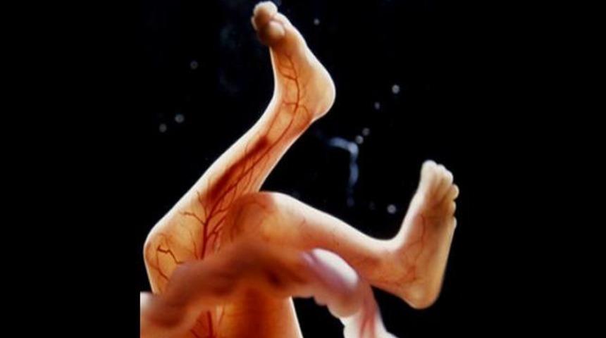 13 haftalık bebek anne karnında ameliyat oldu