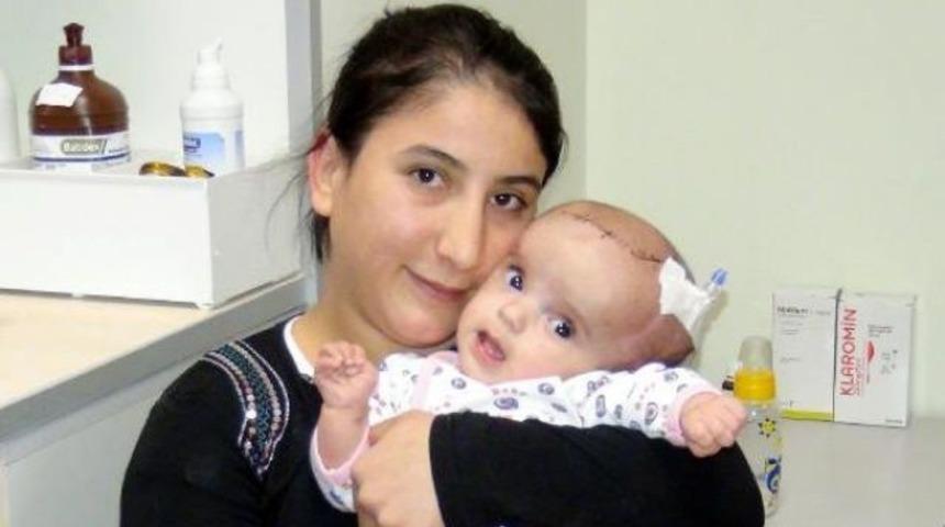 Üç aylık bebeğe beyin ameliyatı