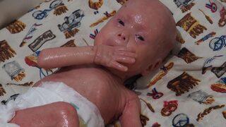 'Yılan bebek' Gökdeniz Tuncer 1 yaşında! Çıplak elle dokunmak, öpmek yasak