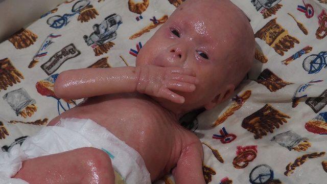 'Yılan bebek' Gökdeniz Tuncer 1 yaşında! Çıplak elle dokunmak, öpmek yasak