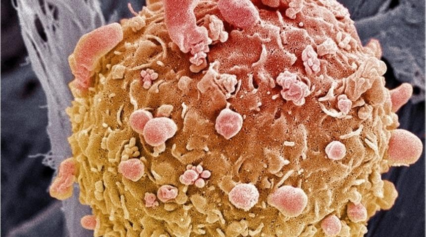 Cilt kanseri tedavisinde '&uuml;mit veren' aşama