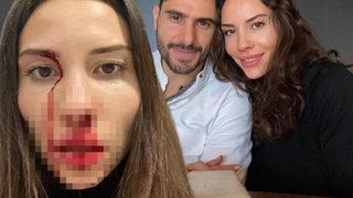 Özer Hurmacı'dan şiddet gören Mihriban Hurmacı: 3 çocuk için 500 TL-1000 TL gönderiyordu