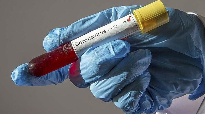Koronavirüste yeni buluş: Süre kısalıyor mu? Sadece 4 dakikada...
