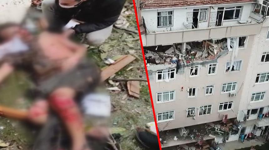 Son dakika: Üsküdar'daki patlamada yeni görüntüler... Ağır yaralıyı böyle sakinleştirdiler