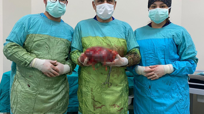 Karnında şişlik şikayetiyle başvurdu, böbreği alındı: İdrar dolu kese haline gelmiş