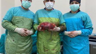 Karnında şişlik şikayetiyle başvurdu, böbreği alındı: İdrar dolu kese haline gelmiş