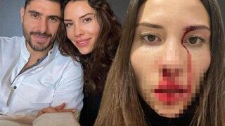 Karısı Mihriban Hurmacı'yı darp eden Özer Hurmacı hakkında flaş karar