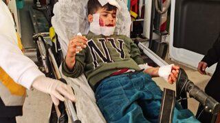 Mardin'de sokak köpeği dehşeti! 7 yaşındaki Ahmet Dal ağır yaralandı