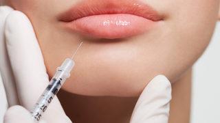  Dudak dolgusu hakkında tüm merak ettikleriniz...