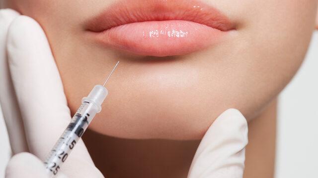  Dudak dolgusu hakkında tüm merak ettikleriniz...