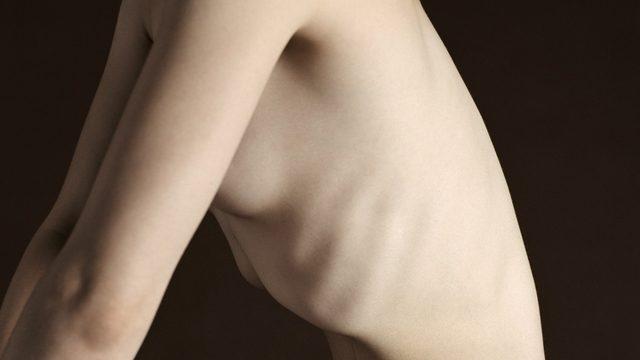 Anoreksiya tedavisinde 'aşk hormonu' işe yarar mı?