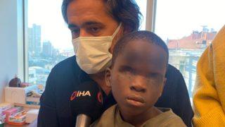 Üvey annesi tarafından asitle gözü yakılan 7 yaşındaki Eby Türkiye'de tedavi olacak