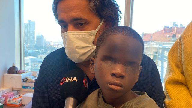 Üvey annesi tarafından asitle gözü yakılan 7 yaşındaki Eby Türkiye'de tedavi olacak