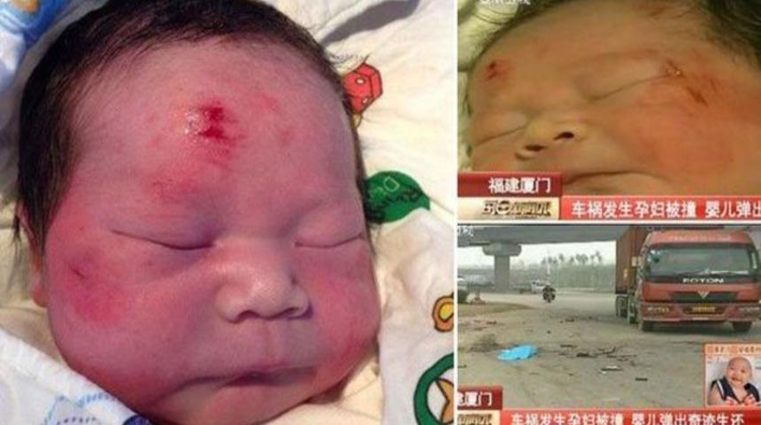 Hamile kadına doğuma giderken TIR &ccedil;arptı, bebeği fırladı