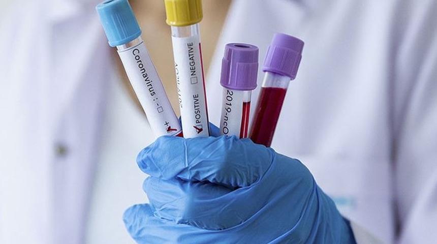 Cesede 41 gün boyunca Covid-19 testi yaptılar! Çıkan sonuç şoke etti