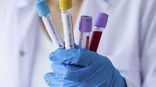 Cesede 41 gün boyunca Covid-19 testi yaptılar! Çıkan sonuç şoke etti