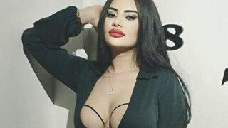 Eski gelin adayı Naz Mila kalça ameliyatı oldu! Sargılar çıksın bakalım