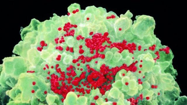 HIV: İlk kez bir kadın virüsten tamamen kurtuldu