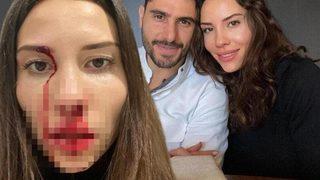 Özer Hurmacı ve darp ettiği Mihriban Hurmacı'ya hapis istemi! Darp edilen eş 3 gün hapse girebilir