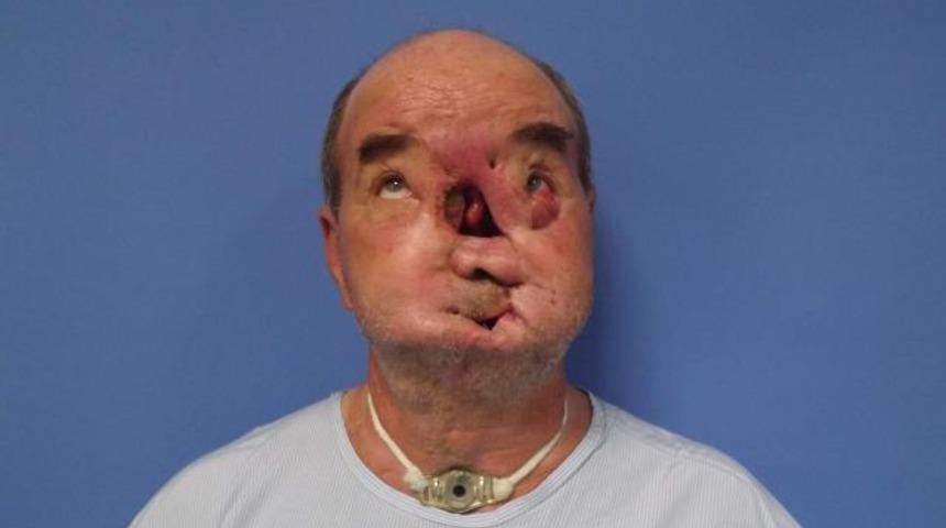 Salih Üslün'ün son hali