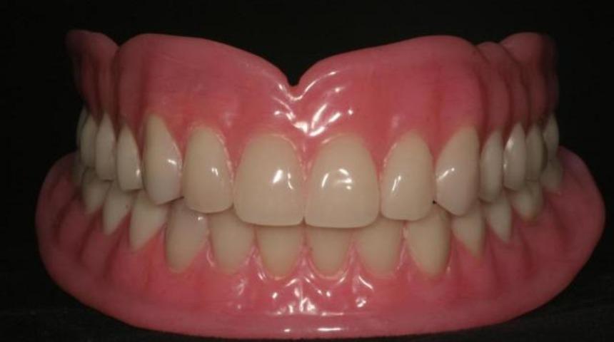 Güzel gülüşler için diş bakımı şart