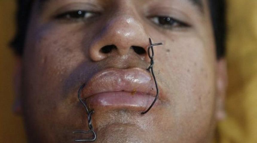 Ağızlarını telle dikip ellerine çivi çaktılar