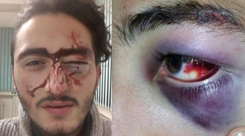 Eve &ccedil;ağırdığı polisler bu hale soktu