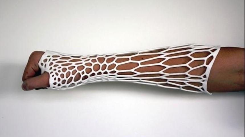 3D yazıcıdan 3 milimetre kalınlığında alçı