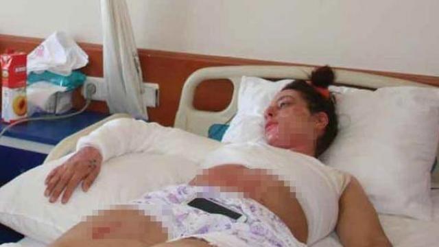 İlk kocası dövdü ikincisi yaktı