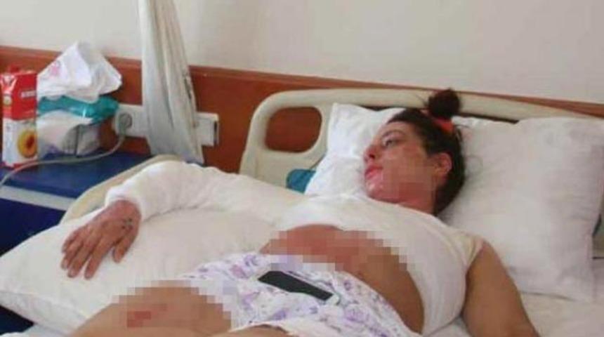 İlk kocası d&ouml;vd&uuml; ikincisi yaktı