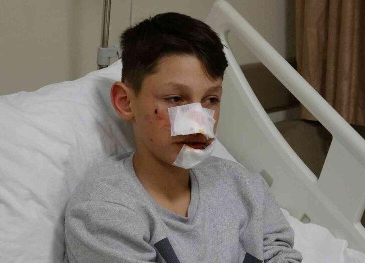 12 yaşındaki çocuk ekmek almaya giderken köpek saldırısıyla bu hale geldi! "Direkt yüzüme saldırdı"