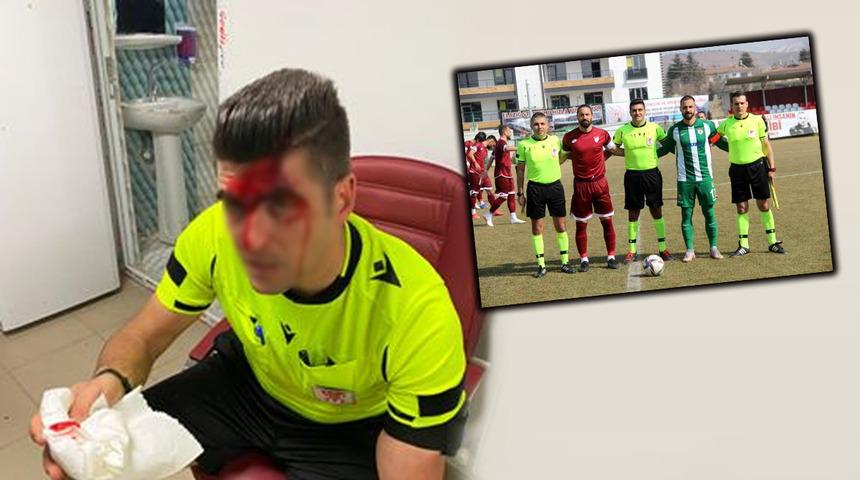 Maçtan kanlar içinde çıktı! Hakemin kafasına bakın ne fırlattılar