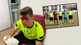 Maçtan kanlar içinde çıktı! Hakemin kafasına bakın ne fırlattılar