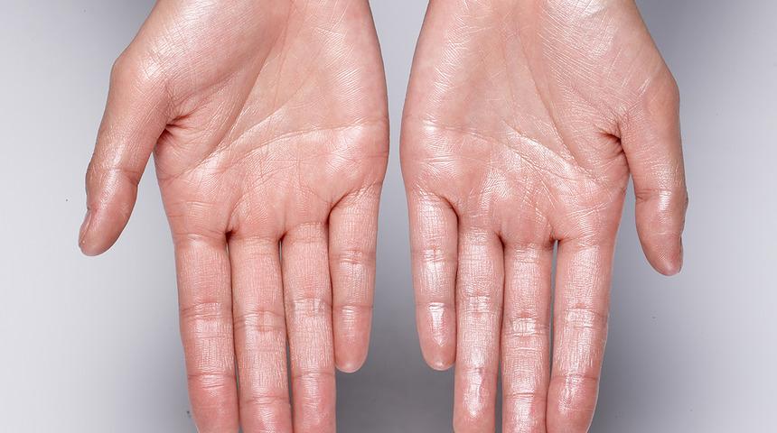 El terlemelerine son