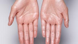 El terlemelerine son