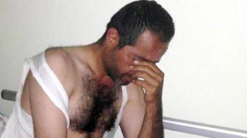 15 g&uuml;n elma yiyerek hayatta kaldı