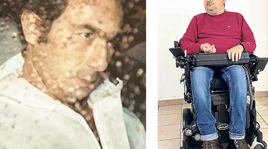 Bir harf yüzünden hayatı altüst oldu... "Söyledim ama dinletemedim, vücuduma hapsoldum"