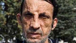 Yüz nakli olan Uğur Acar lise diploması aldı! ''Hedefim üniversite''