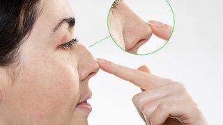 Burnun şekil bozukluklarını düzeltmek mümkün 