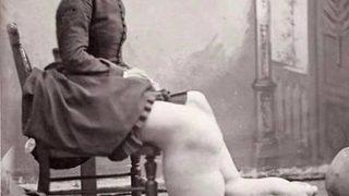 Tüyler ürperten bir hikaye! “Fil ayaklı” diyerek alay edilen sirklerde gösteri yapmaya zorlanan kadın: Fanny Mills