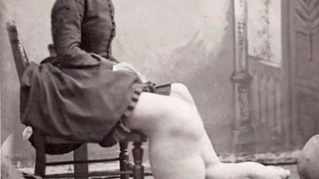 Tüyler ürperten bir hikaye! “Fil ayaklı” diyerek alay edilen sirklerde gösteri yapmaya zorlanan kadın: Fanny Mills