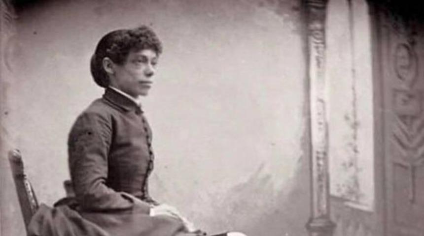 Tüyler ürperten bir hikaye! “Fil ayaklı” diyerek alay edilen sirklerde gösteri yapmaya zorlanan kadın: Fanny Mills