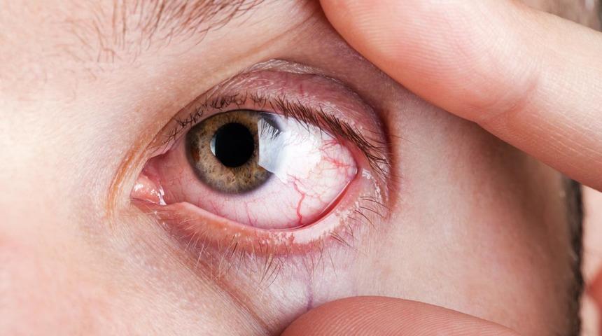 Duyanları korkutuyor: Bir anda görme kaybına neden olabilir