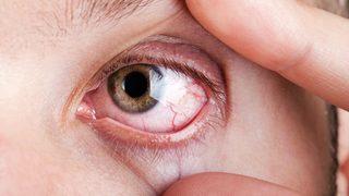 Duyanları korkutuyor: Bir anda görme kaybına neden olabilir