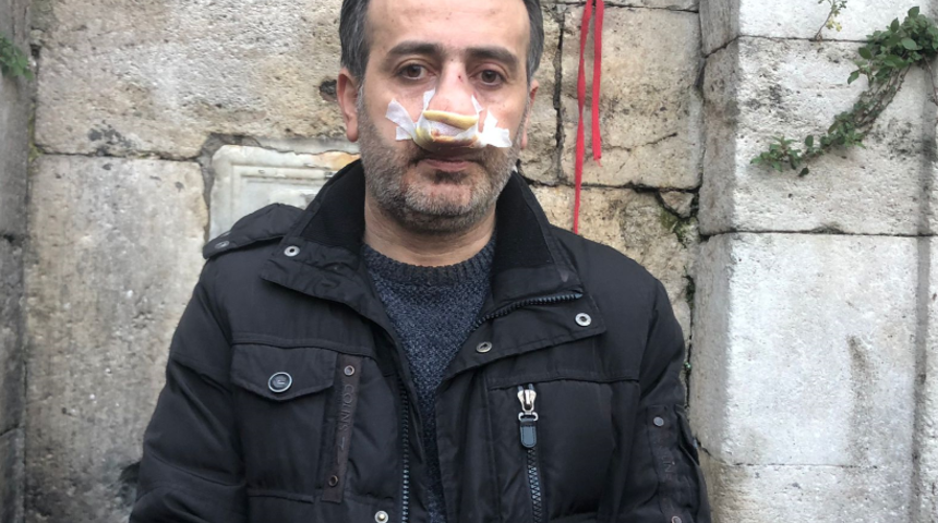 İstanbul'da akılalmaz olay! ''Polisin gözü önünde dövüldüm, müdahale etmediler''