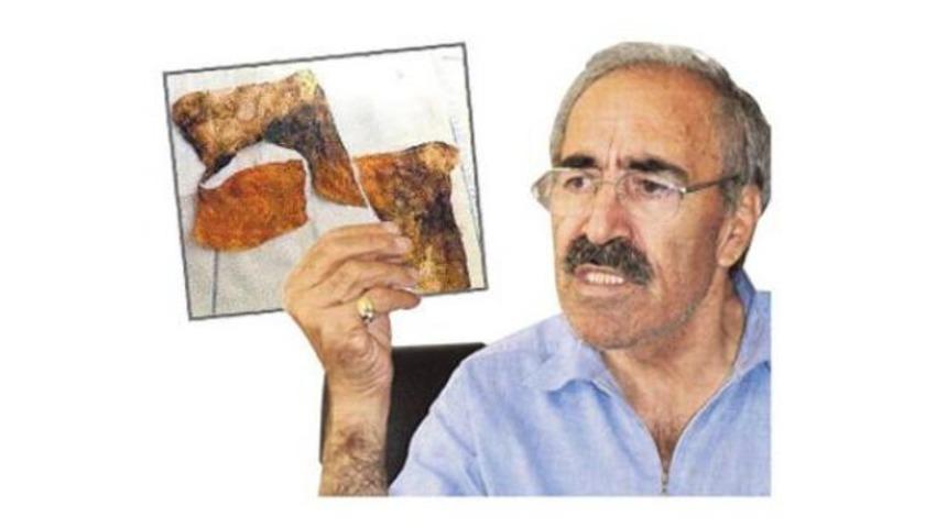 Midesinden öyle bir şey çıktı ki...