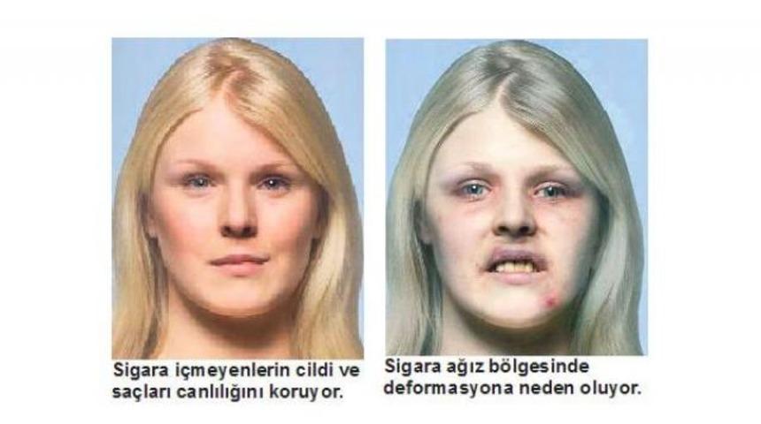 Sigara y&uuml;z&uuml;n&uuml;z&uuml; bu hale getiriyor