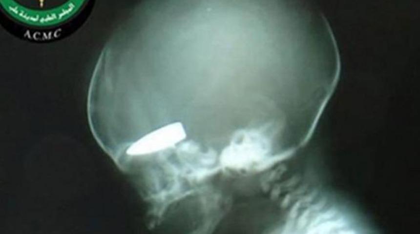 İddiaya girip hamile avlıyorlar