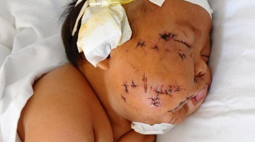 Bebeğini bu hale getirdi!